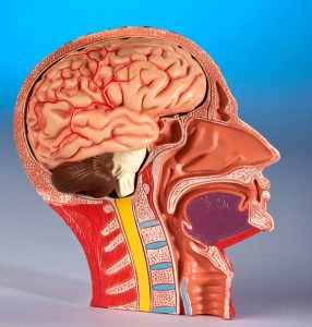 מיגרנה כרונית